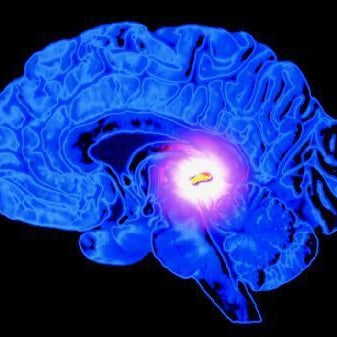 Pineal Gland Stimulation Exercise for Recieving your Spiritual Messages by Dream Wise